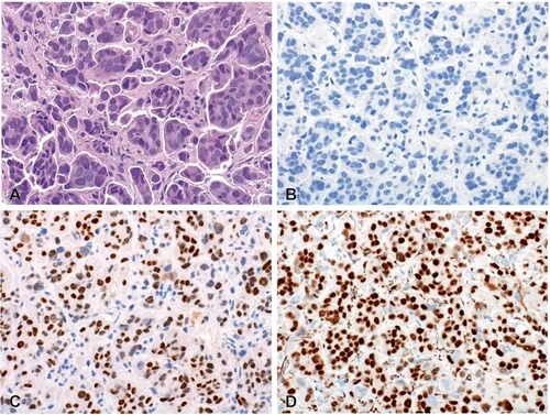 免疫组化（IHC）检测 - 苏州臻致生物科技有限公司